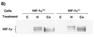 Western Blot: HIF-1 alpha Antibody Pack [NB100-905]