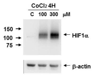 Western Blot: HIF-1 alpha Antibody [NB100-449]