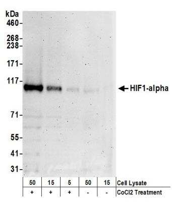 Western Blot: HIF-1 alpha Antibody [NB100-449]