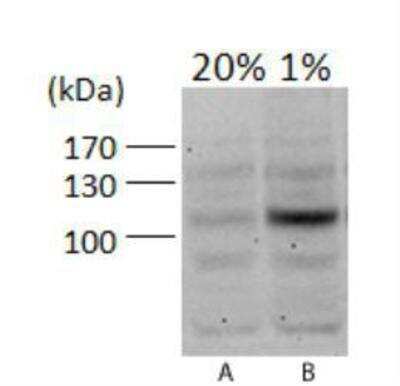 Western Blot Analysis of HIF-1 alpha in PC12 Cells at 20% and 1% Oxygen