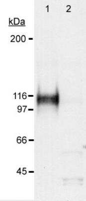 Western Blotting of HIF-1 alpha in Treated and Untreated Cos-7 Nuclear Extract