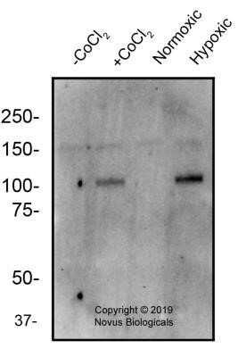 Western Blot: HIF-2 alpha/EPAS1 Antibody (2444A)Azide and BSA Free [NBP2-80767]
