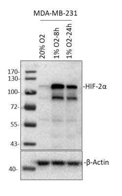 Western Blot: HIF-2 alpha/EPAS1 Antibody (2444A)BSA Free [NBP2-76454]