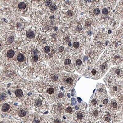 Immunohistochemistry-Paraffin: HIF-2 alpha/EPAS1 Antibody (2597C) - BSA Free [NBP3-07075]