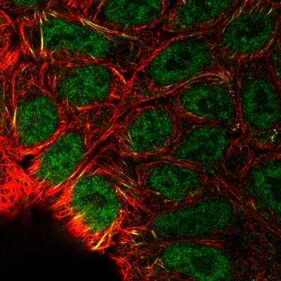Immunocytochemistry/ Immunofluorescence: HIF-2 alpha/EPAS1 Antibody [NBP2-76564]