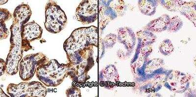 Immunohistochemistry: HIF-2 alpha/EPAS1 Antibody Pack [NB100-902HIF2]