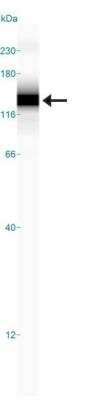 Simple Western: HIF-2 alpha/EPAS1 Antibody Pack [NB100-902HIF2]