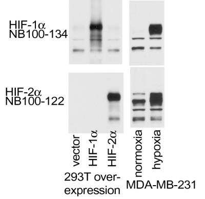 Western Blot Analysis of HIF-2 alpha/EPAS1 in Overexpression and MDA-MB-231 Cell Lysates