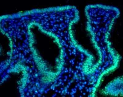 Immunohistochemistry: HIF-2 alpha/EPAS1 Antibody (ep190b) - Azide and BSA Free [NBP2-80766]