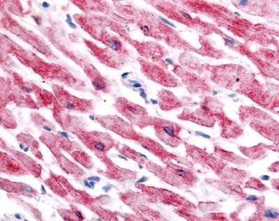 Immunohistochemistry: HIF-2 alpha/EPAS1 Antibody (ep190b) - Azide and BSA Free [NBP2-80766]