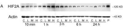 Western Blot: HIF-2 alpha/EPAS1 Antibody (ep190b)Azide and BSA Free [NBP2-80766]