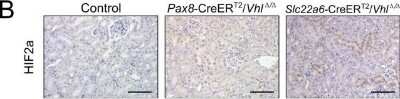 Immunohistochemistry-Paraffin: HIF-2 alpha/EPAS1 Antibody (ep190b) [NB100-132]