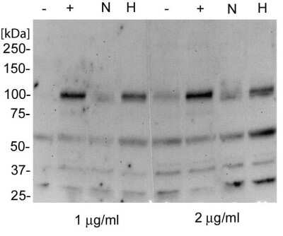 Western Blot: HIF-2 alpha/EPAS1 Antibody (ep190b) [NB100-132]