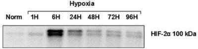 Western Blot: HIF-2 alpha/EPAS1 Antibody (ep190b) [NB100-132]