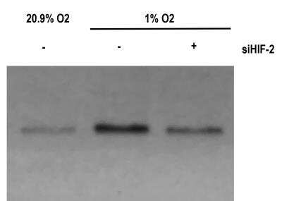 Western Blot: HIF-2 alpha/EPAS1 Antibody (ep190b) [NB100-132]