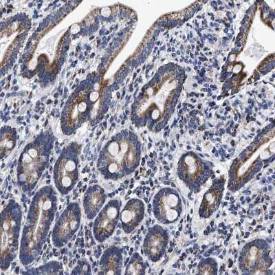 Immunohistochemistry-Paraffin: HINT2 Antibody [NBP1-86024]