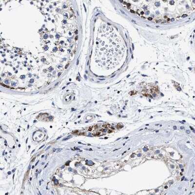 Immunohistochemistry-Paraffin: HINT2 Antibody [NBP1-86024]