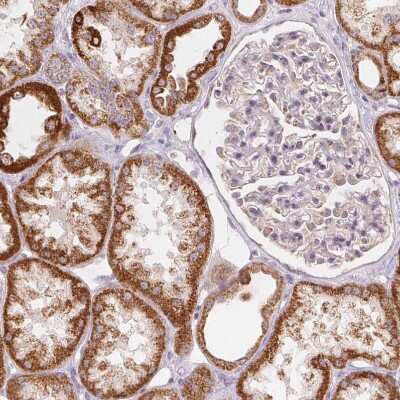 Immunohistochemistry-Paraffin: HINT2 Antibody [NBP2-56156]