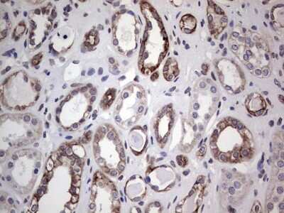 Immunohistochemistry: HIP-55 Antibody (OTI6C9) [NBP2-46428]