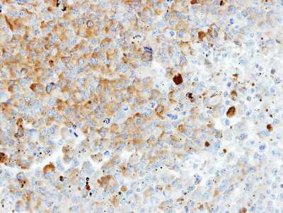 Immunohistochemistry-Paraffin: HIP-55 Antibody [NBP1-31026]
