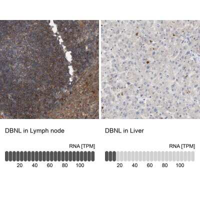 Immunohistochemistry-Paraffin: HIP-55 Antibody [NBP1-91988]