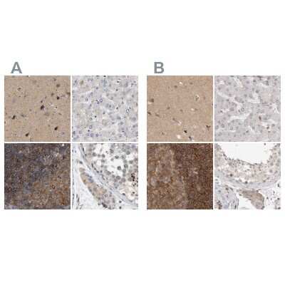 Immunohistochemistry-Paraffin: HIP-55 Antibody [NBP1-91988]