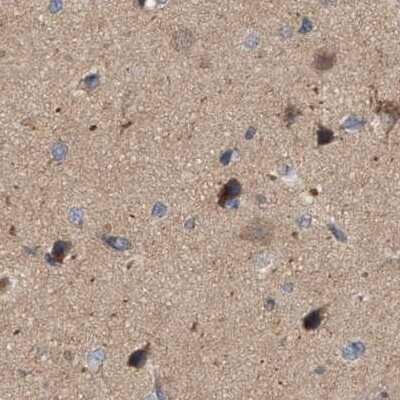 Immunohistochemistry-Paraffin: HIP-55 Antibody [NBP1-91988]