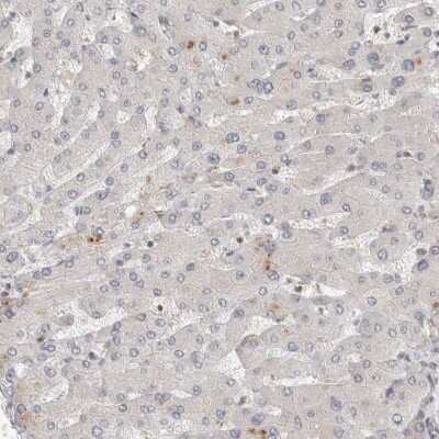 Immunohistochemistry-Paraffin: HIP-55 Antibody [NBP1-91989]