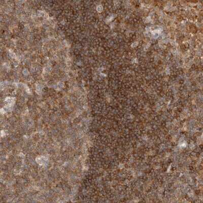 Immunohistochemistry-Paraffin: HIP-55 Antibody [NBP1-91989]