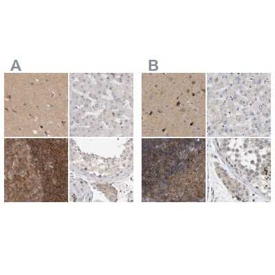 Immunohistochemistry-Paraffin: HIP-55 Antibody [NBP1-91989]