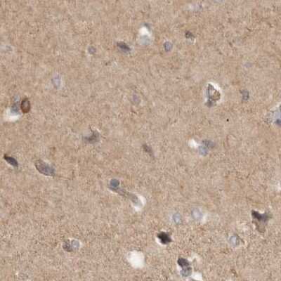 Immunohistochemistry-Paraffin: HIP-55 Antibody [NBP1-91989]