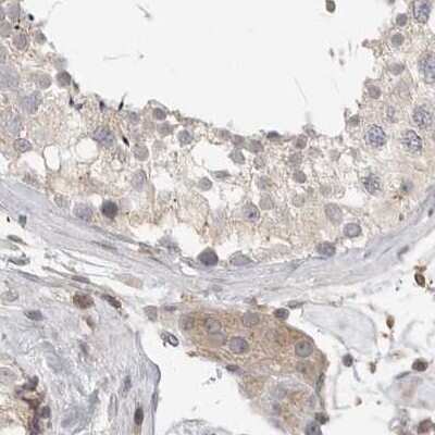 Immunohistochemistry-Paraffin: HIP-55 Antibody [NBP1-91989]