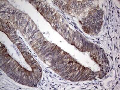 Immunohistochemistry: HIP-55 Antibody (OTI6C9) - Azide and BSA Free [NBP2-71841]