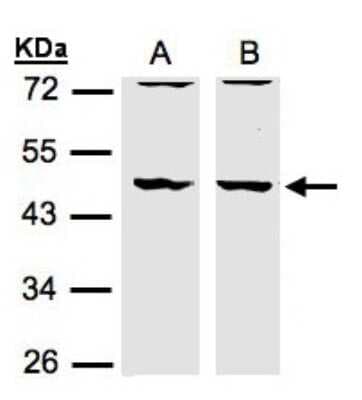 Western Blot: HIP-55 Antibody [NBP1-31026]
