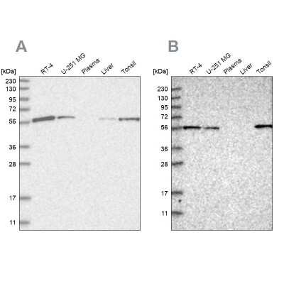 Western Blot: HIP-55 Antibody [NBP1-91989]