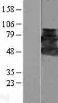 Western Blot: HIP-55 Overexpression Lysate [NBL1-09731]