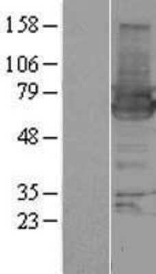 Western Blot: HIP-55 Overexpression Lysate [NBP2-11007]