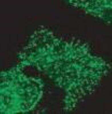 Immunocytochemistry/ Immunofluorescence: HIP1 Antibody (1B11) [NB300-204]
