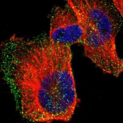 Immunocytochemistry/ Immunofluorescence: HIP1 Antibody [NBP1-81592]