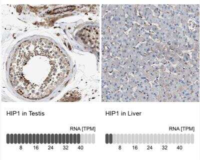 Immunohistochemistry-Paraffin: HIP1 Antibody [NBP1-81592]