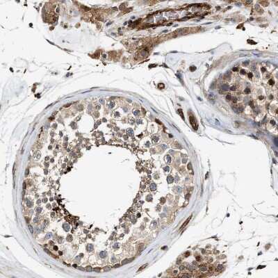 Immunohistochemistry-Paraffin: HIP1 Antibody [NBP1-81592]