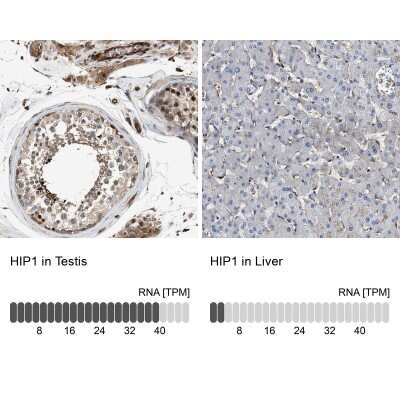 Immunohistochemistry-Paraffin: HIP1 Antibody [NBP1-81592]