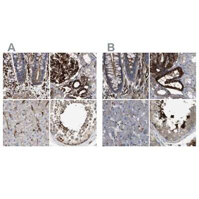 Immunohistochemistry-Paraffin: HIP1 Antibody [NBP1-81592]