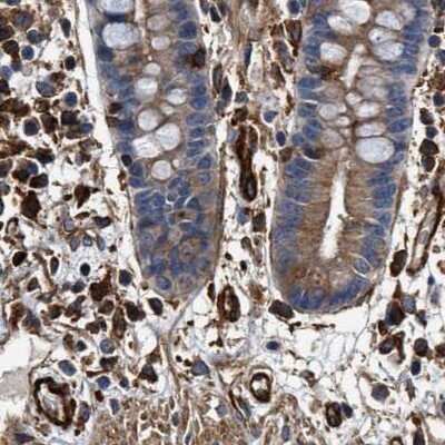 Immunohistochemistry-Paraffin: HIP1 Antibody [NBP1-81592]