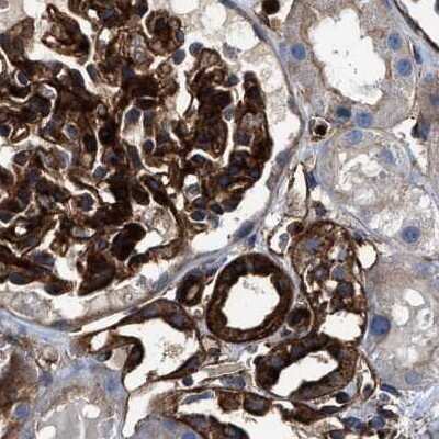 Immunohistochemistry-Paraffin: HIP1 Antibody [NBP1-81592]