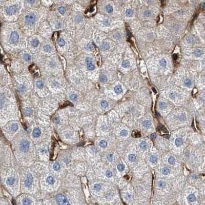 Immunohistochemistry-Paraffin: HIP1 Antibody [NBP1-81592]