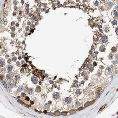 Immunohistochemistry-Paraffin: HIP1 Antibody [NBP1-81592]