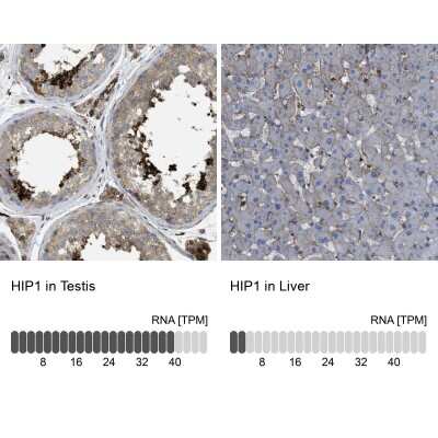 Immunohistochemistry-Paraffin: HIP1 Antibody [NBP1-81593]