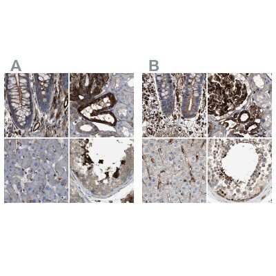 Immunohistochemistry-Paraffin: HIP1 Antibody [NBP1-81593]