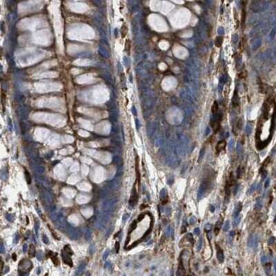 Immunohistochemistry-Paraffin: HIP1 Antibody [NBP1-81593]